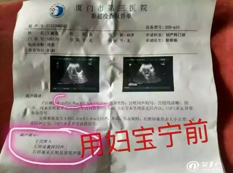 子宫肌瘤用妇宝宁两套冶愈好案例_妇科用药_