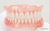 牙齿种植-牙齿种植一般多少钱一颗缩略图1