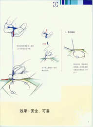 北京正规可吸收颅骨固定架厂家