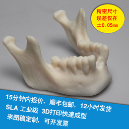 3D打印手板模型 医疗器械手板模型 3D打印**骨架手板