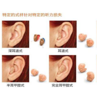 专家提醒助听器验配注意事项