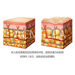 蛋白酶埋线、蛋白埋线、类人肽