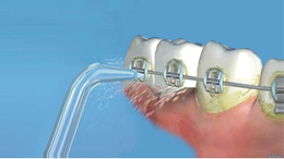 超声波洗牙联系方式-德家口腔(在线咨询)-超声波洗牙