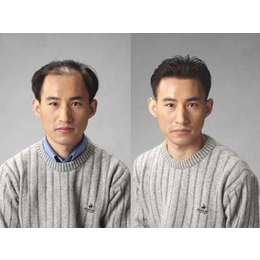 广州假发套多少钱-和事发制品(在线咨询)-广州假发套