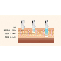 雷达冰雕仪器,柏美美容设备厂,铁岭雷达冰雕