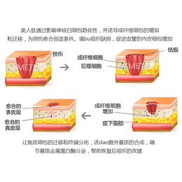 线雕_类人肽_线雕鼻子和假体哪种好