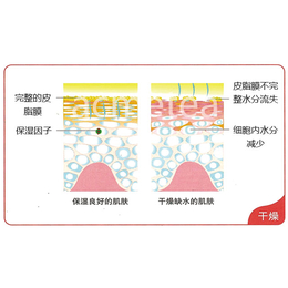 类人肽_超声刀_热拉提和超声刀的区别