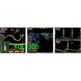 日本*克SONIC鱼体长鱼群探测器KCE-300