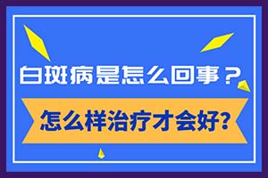 白癜风的治疗与环境的因素有联系吗