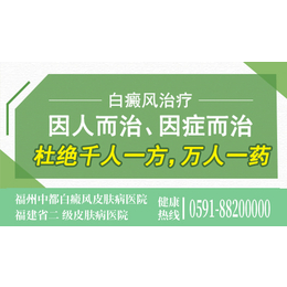 古田老年人看白癜风的医院哪里比较好  诊疗白斑的费用多少