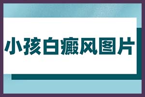 郑州西京白癜风医院挂预约网几点放号-地址在哪里