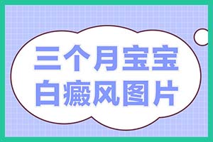 白癜风早期是否能够被治好-治白优选郑州西京