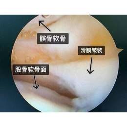 秦淮膝关节-膝关节恢复-冷水医学科技(诚信商家)