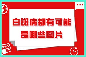 品质优先!福州的皮肤病专科，白癜风究是什么病