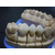 深圳义齿加工烤瓷牙加工全瓷牙加工种植牙加工牙齿加工厂国际义齿缩略图4