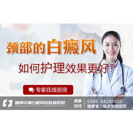 光泽那个医院看白癫疯好