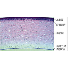 宿迁视力矫正-戴明视-矫正视力镜