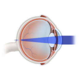 视力恢复训练-视力训练-护瞳医疗科技(查看)
