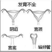 被检查出有始基子宫，我还可以做深圳三代试管婴儿吗？