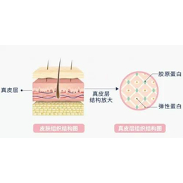 *美疗深层腿黑-凉山*美疗-美邦(查看)